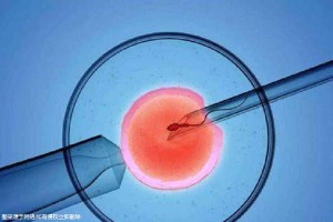 关于拉拉供卵服务微信群
